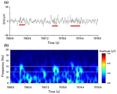 Factors affecting discrepancies between scorers in manual sleep spindle detections in single-channel electroencephalography in young adult males